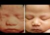Ultrasound Me baby ki smile 😊 / ultrasound video/sonography / ultrasound baby smile ☺️ #ultrasound