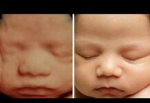 Ultrasound Me baby ki smile 😊 / ultrasound video/sonography / ultrasound baby smile ☺️ #ultrasound