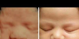 Ultrasound Me baby ki smile 😊 / ultrasound video/sonography / ultrasound baby smile ☺️ #ultrasound