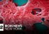 Concerns over Legionnaires' disease are growing in the Bronx